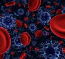 Poruchy krve u dospělých: příznaky, které se vyskytují v závislosti na nemoci