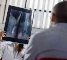 Proč X-ray žaludku?
