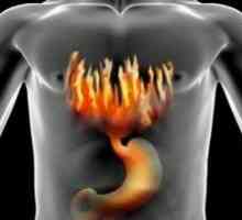 Žluči v žaludku: příčiny a různé způsoby léčby této nemoci