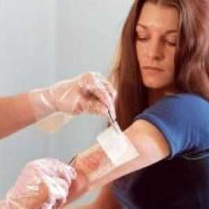 Skin Absces - příznaky a léčba