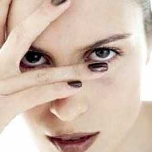 Alergický zánět oční spojivky