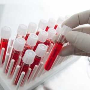 Alt analýza krve: toto je standard a odchylka od normy