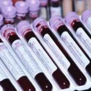 Amyláza v krvi: normou a odchylka od normy