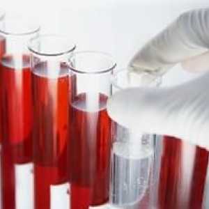 Krevní testy, výzkum na hormony a dekódování
