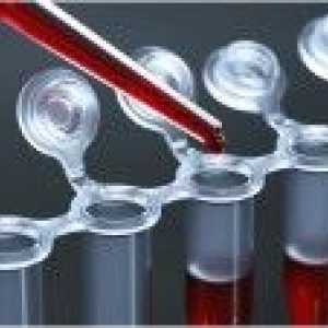 Krevní test pro hormony štítné žlázy a proteinů: příprava pro studium, interpretace výsledků