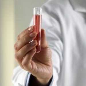 Krevní test pro imunitní status: indikace a vlastností