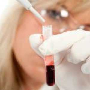 Krevní test na emf