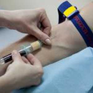 Co je krevní test rw a její interpretace