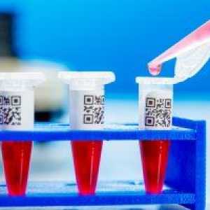 Krevní testy na rakovinných buňkách a její interpretace