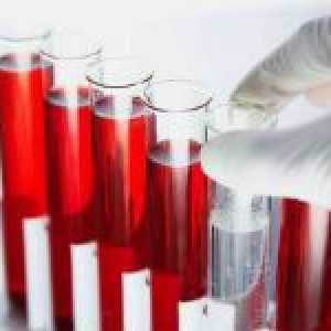 Analýza z krve na TTG