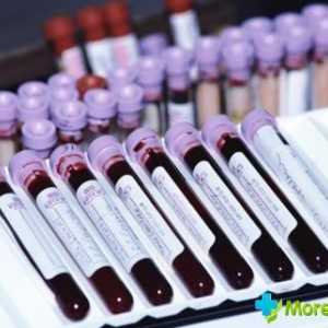 Krevní test v průběhu těhotenství: rozluštění základní ukazatele
