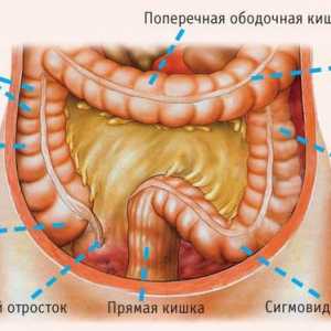 Anatomie a onemocnění tlustého střeva