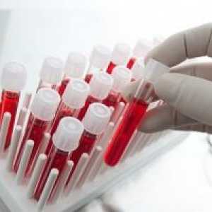 Erytrocytární protilátky: typy, diagnostika a dekódovací studie