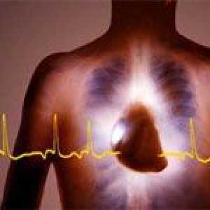 Sinus (sinus), nepravidelný srdeční rytmus