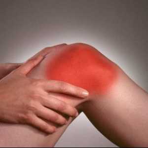 Artritida kolene