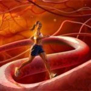Ateroskleróza tepen dolních končetin a jejich léčení