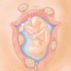 Těhotenství a porod děložní myomy