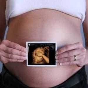 Je bezpečné ultrazvuku v průběhu těhotenství?