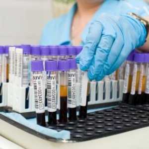 Biochemické vyšetření krve: dekódování tabulky pro hlavní hodnoty