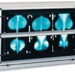 Divák X-ray může pomoci kardiologů?