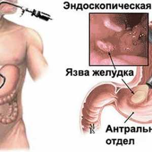 Metody pro kontrolu žaludku bez polykání sondy
