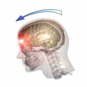 Traumatické poranění mozku (TBI), poranění hlavy: příčiny, typy, příznaky, léčba
