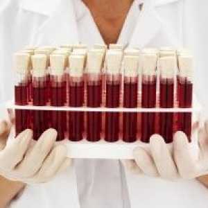 Příčiny zvýšení proteinu v krvi a možných chorob