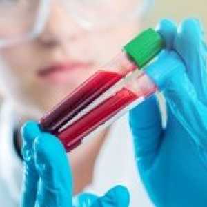 Co je to - GMT: jmenování na krevní test, rychlost enzymu a možného onemocnění