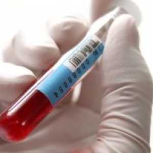 Alp normou v biochemické analýze krve a způsobuje, že abnormality enzymů