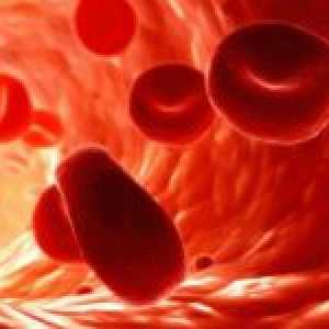 Co na obrázku MCV krev a jaká je jeho pravidlo?