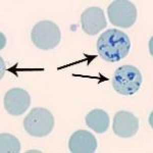 Co retikulocytů v krevním testem