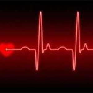 Co je srdeční arytmie, a zda je to nebezpečné pro život?