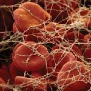 Co je hemostáza a v jakých případech provést krevní test na něm