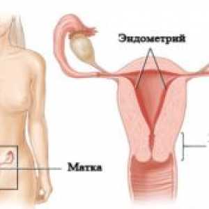Co je hypoplastický děložní sliznice?