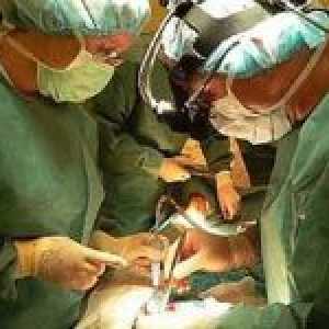 Co je kardiovaskulární chirurgie