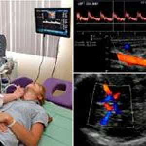 Diagnostické schopnosti ultrazvuk mozkových cév