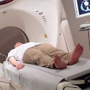 Co je počítačová tomografie břicha?