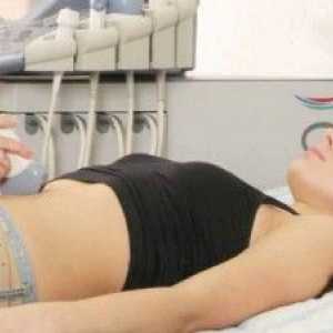 Diagnóza děložních myomů: když je čas na ultrazvuk?