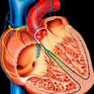 Dilatační kardiomyopatie (DCM) a její léčba