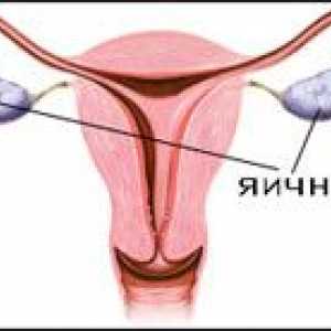 Ovariální dysfunkce (porucha vaječníku prací)