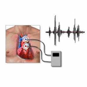 Phonocardiography (PCG), co to je, diagnostické funkce a její interpretace