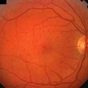 Pozadí retinopatie oka