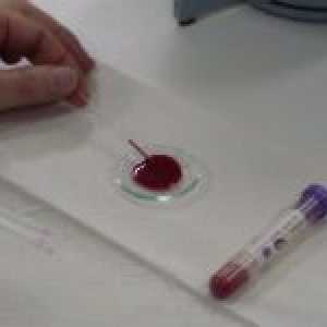 Důvody pro zvýšení hematokritu v krvi