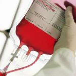Kompatibilita skupina krve a Rh faktor transfuze