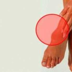 Hygrom nohou: Léčba doma