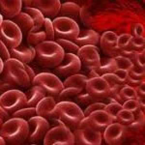 Hyperkoagulace krve a jeho léčbě