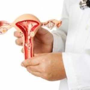 Hyperplazie endometria - jak rozpoznat příznaky? správné diagnózy