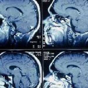 Metody výzkumu cév mozku