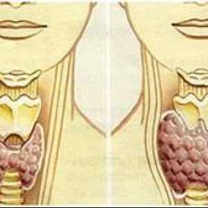 Hypothyroidism - nebezpečná nemoc, která by neměla být ignorována