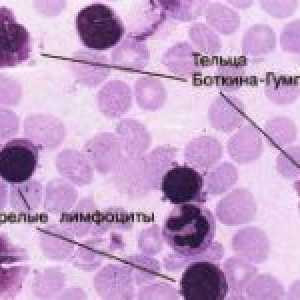 Chronická krev leukémie